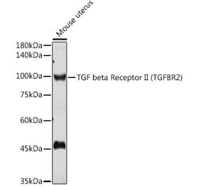 Western Blot - Anti-TGF beta Receptor II Antibody (A80719) - Antibodies.com