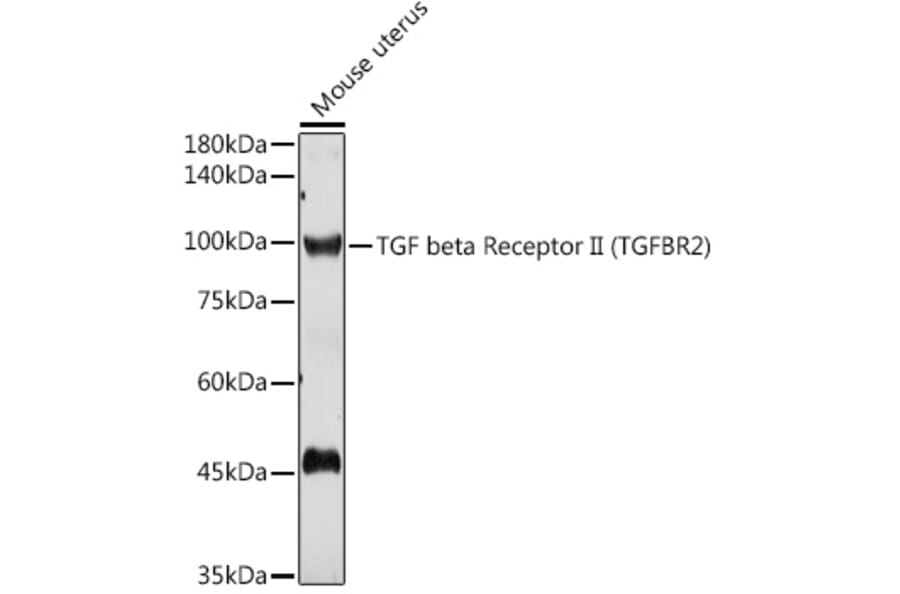 Western Blot - Anti-TGF beta Receptor II Antibody (A80719) - Antibodies.com