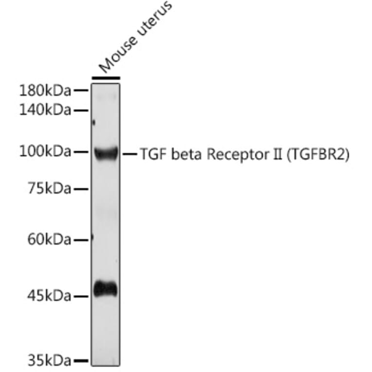 Western Blot - Anti-TGF beta Receptor II Antibody (A80719) - Antibodies.com