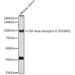 Western Blot - Anti-TGF beta Receptor II Antibody (A80719) - Antibodies.com
