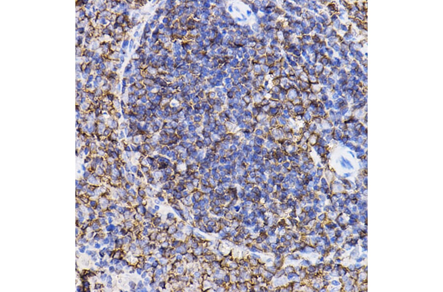 Immunohistochemistry - Anti-TGF beta Receptor II Antibody (A80719) - Antibodies.com