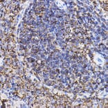 Immunohistochemistry - Anti-TGF beta Receptor II Antibody (A80719) - Antibodies.com