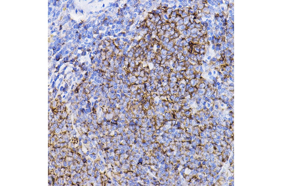 Immunohistochemistry - Anti-TGF beta Receptor II Antibody (A80719) - Antibodies.com