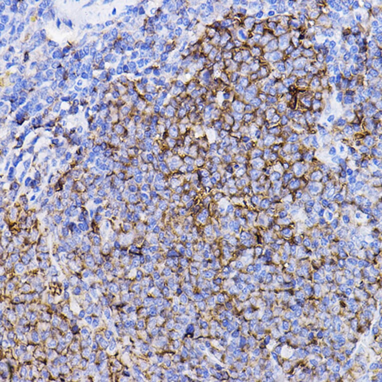 Immunohistochemistry - Anti-TGF beta Receptor II Antibody (A80719) - Antibodies.com