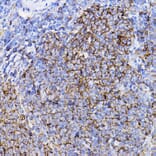 Immunohistochemistry - Anti-TGF beta Receptor II Antibody (A80719) - Antibodies.com