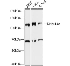 Western Blot - Anti-Dnmt3a Antibody (A80721) - Antibodies.com