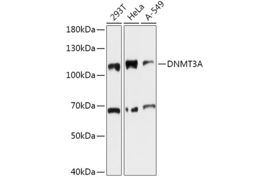 Western Blot - Anti-Dnmt3a Antibody (A80721) - Antibodies.com