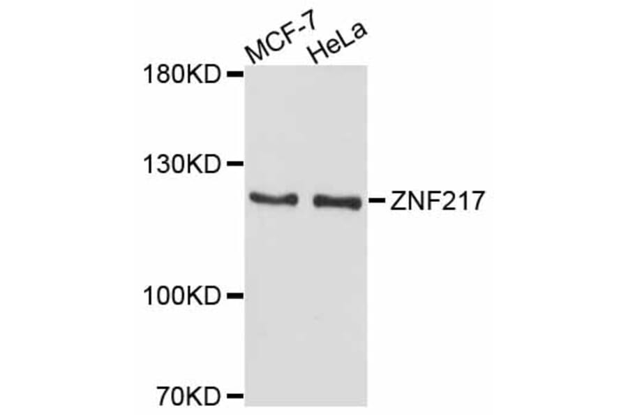Western Blot - Anti-ZNF217 Antibody (A11812) - Antibodies.com