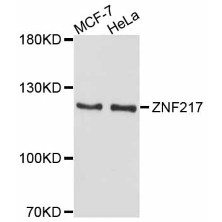 Western Blot - Anti-ZNF217 Antibody (A11812) - Antibodies.com