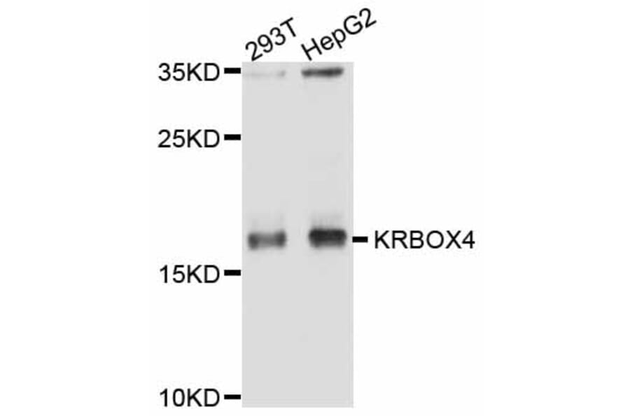 Western Blot - Anti-KRBOX4 Antibody (A11815) - Antibodies.com