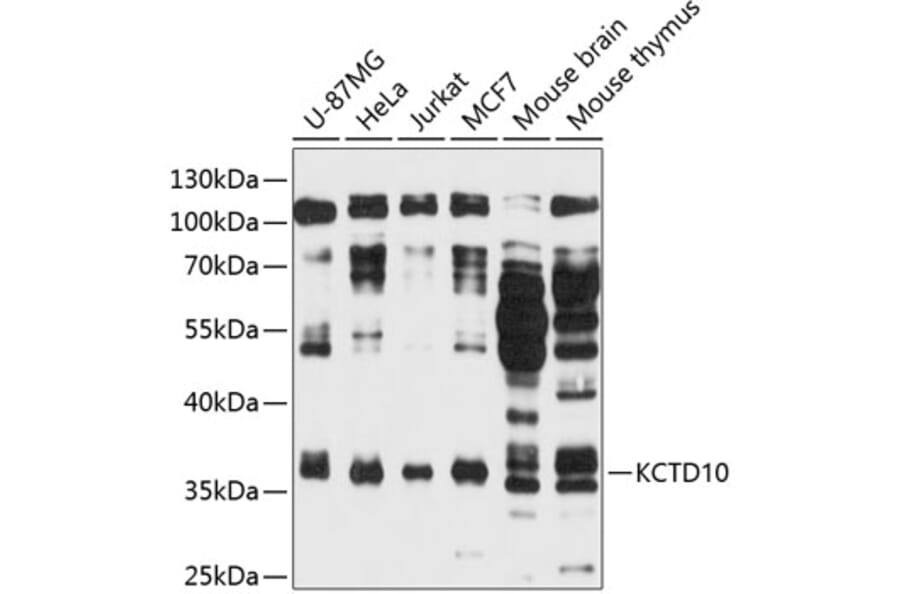 Western Blot - Anti-KCTD10 Antibody (A11941) - Antibodies.com