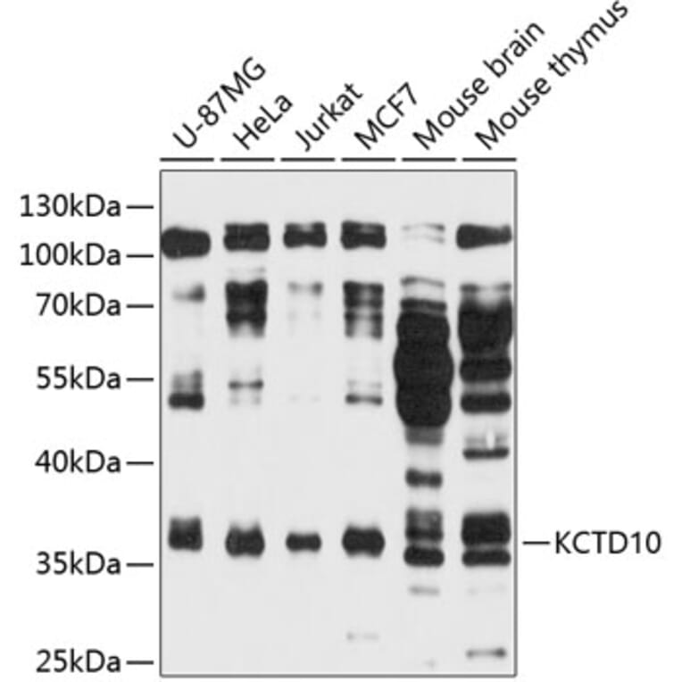 Western Blot - Anti-KCTD10 Antibody (A11941) - Antibodies.com