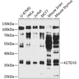 Western Blot - Anti-KCTD10 Antibody (A11941) - Antibodies.com
