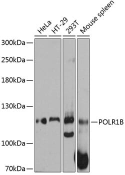Western blot analysis of extracts of various cell lines, using Anti-POLR1B Antibody (A12034) at 1:3000 dilution.
Secondary antibody: Goat Anti-Rabbit IgG (H+L) (HRP) (AS014) at 1:10,000 dilution.
Lysates / proteins: 25µg per lane.
Blocking buffer: 3% non-fat dry milk in TBST.
Detection: ECL Basic Kit (RM00020).
Exposure time: 10s.