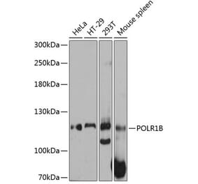 Western Blot - Anti-POLR1B Antibody (A80729) - Antibodies.com