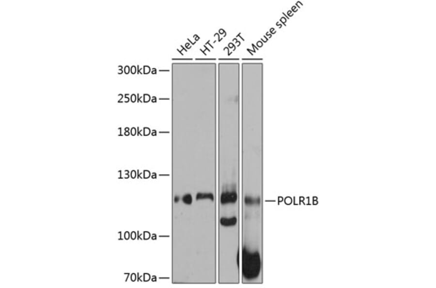 Western Blot - Anti-POLR1B Antibody (A80729) - Antibodies.com