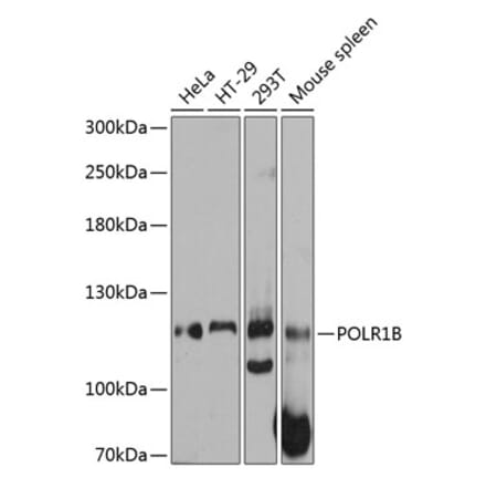 Western Blot - Anti-POLR1B Antibody (A80729) - Antibodies.com
