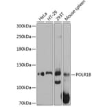 Western Blot - Anti-POLR1B Antibody (A80729) - Antibodies.com