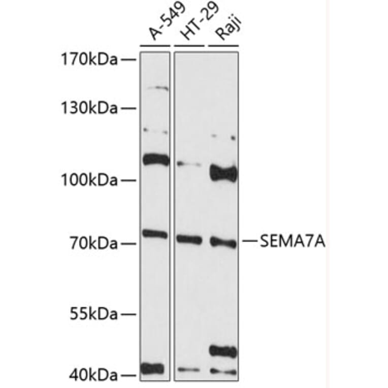 Western Blot - Anti-Semaphorin 7a Antibody (A80731) - Antibodies.com