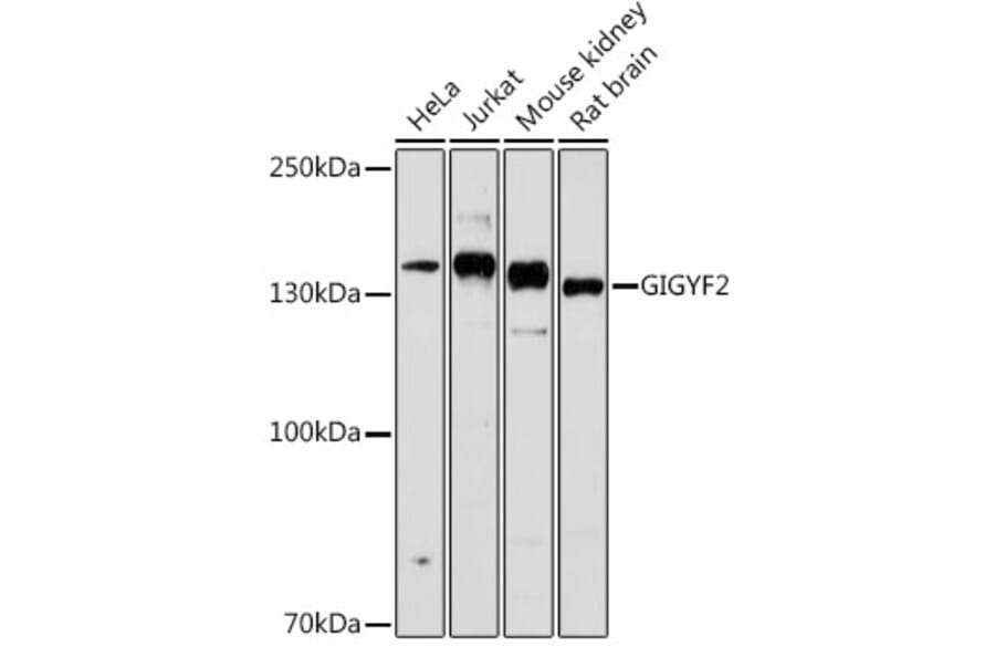 Western Blot - Anti-GIGYF2 Antibody (A80732) - Antibodies.com