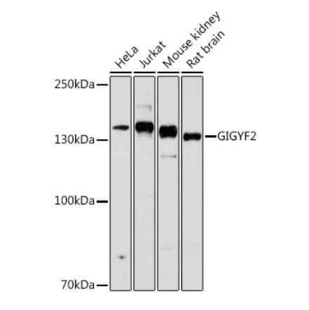 Western Blot - Anti-GIGYF2 Antibody (A80732) - Antibodies.com