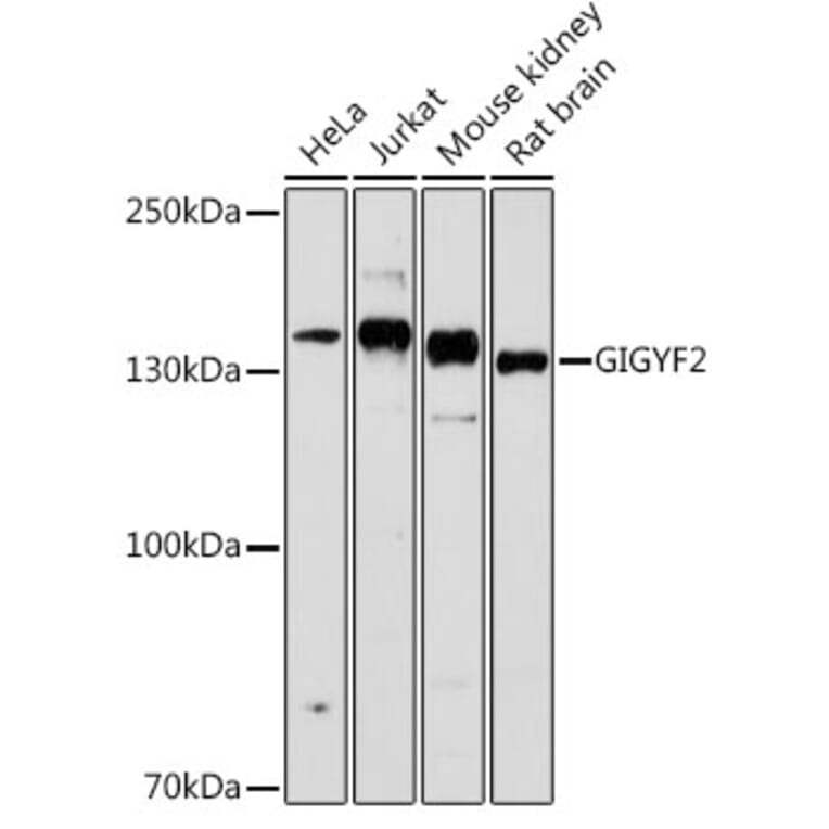 Western Blot - Anti-GIGYF2 Antibody (A80732) - Antibodies.com