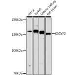 Western Blot - Anti-GIGYF2 Antibody (A80732) - Antibodies.com