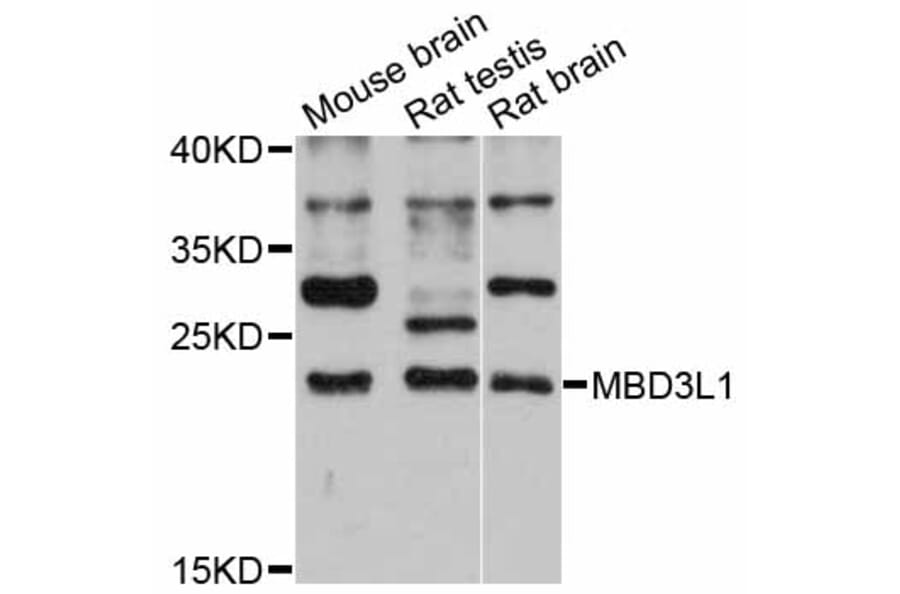 Western Blot - Anti-MBD3L1 Antibody (A12081) - Antibodies.com