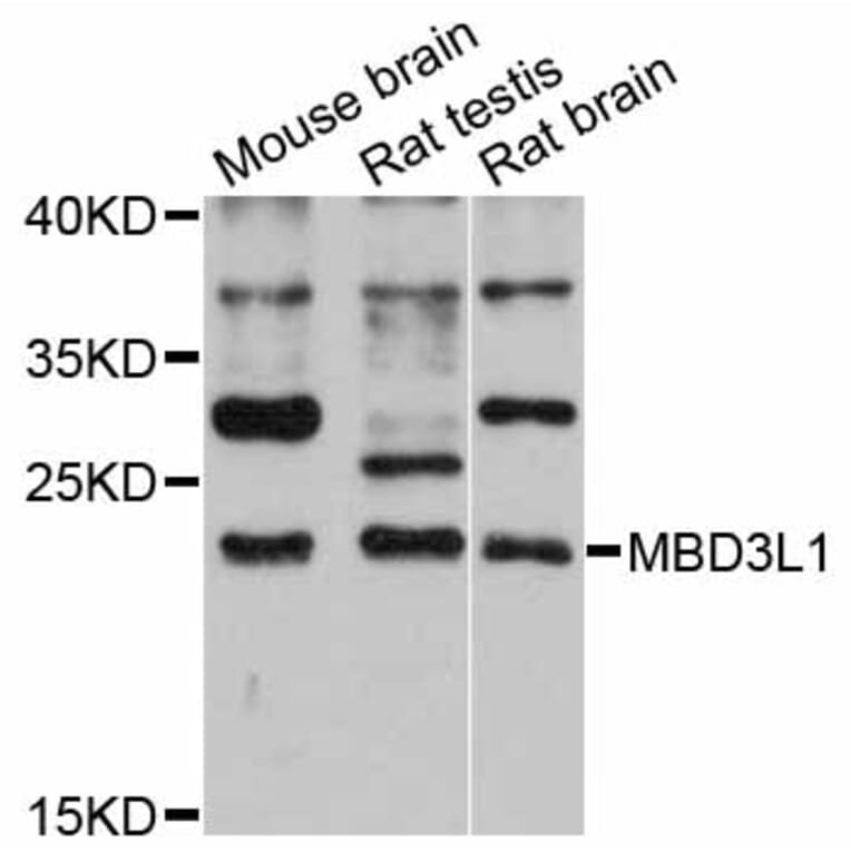 Western Blot - Anti-MBD3L1 Antibody (A12081) - Antibodies.com