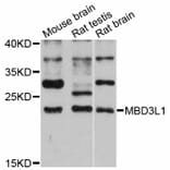 Western Blot - Anti-MBD3L1 Antibody (A12081) - Antibodies.com