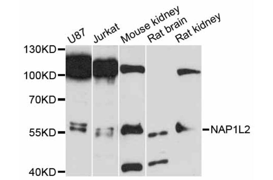 Western Blot - Anti-NAP1L2 Antibody (A12087) - Antibodies.com