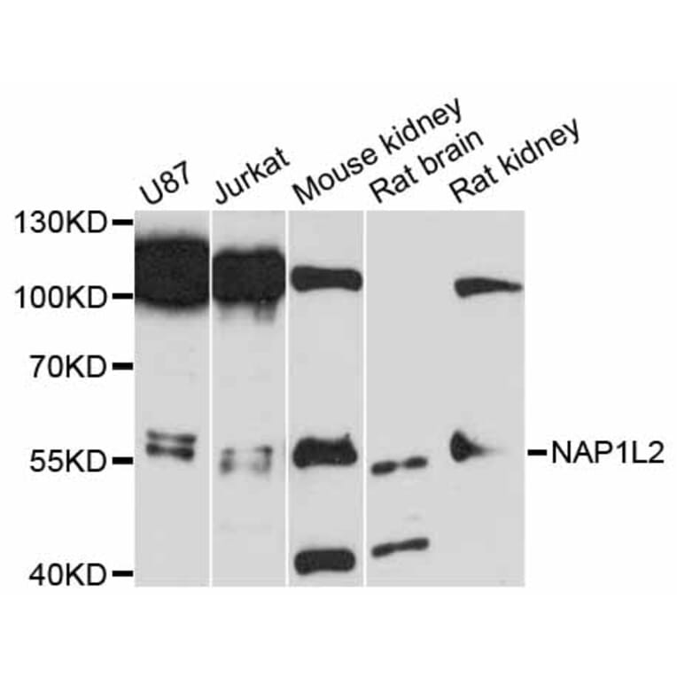 Western Blot - Anti-NAP1L2 Antibody (A12087) - Antibodies.com
