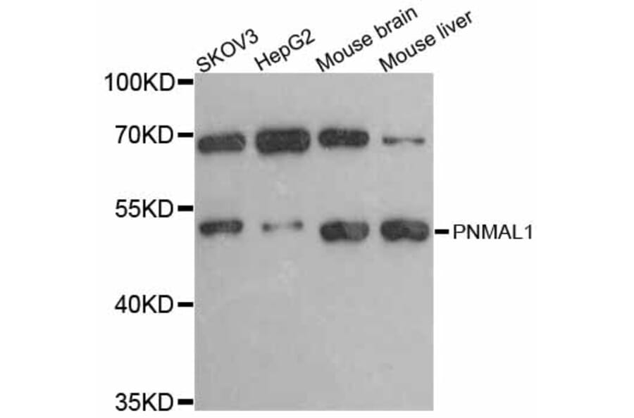 Western Blot - Anti-PNMAL1 Antibody (A12092) - Antibodies.com
