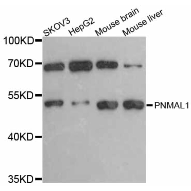 Western Blot - Anti-PNMAL1 Antibody (A12092) - Antibodies.com