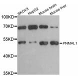 Western Blot - Anti-PNMAL1 Antibody (A12092) - Antibodies.com