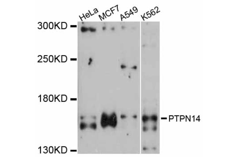 Western Blot - Anti-PTPN14 Antibody (A12093) - Antibodies.com