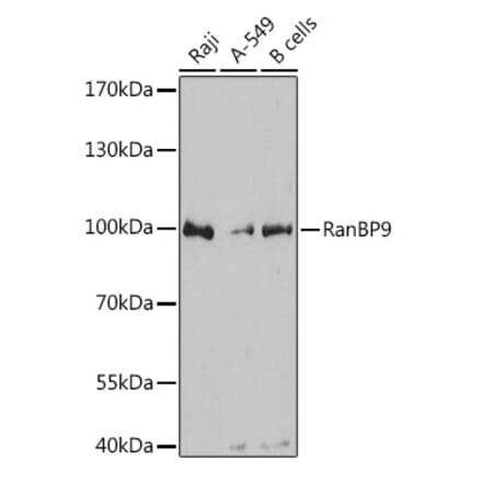 Western Blot - Anti-RANBP9 Antibody (A80737) - Antibodies.com