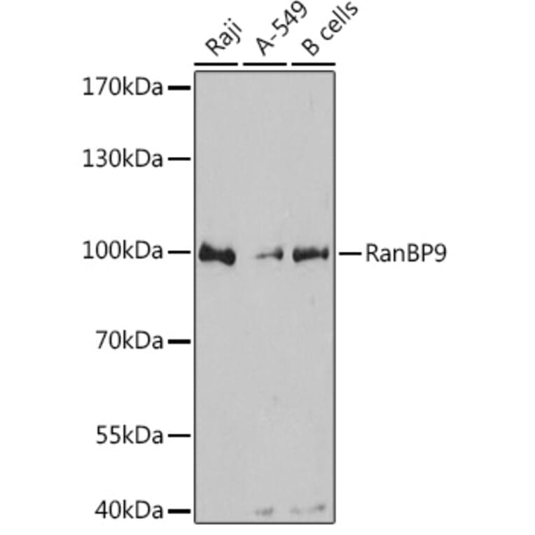 Western Blot - Anti-RANBP9 Antibody (A80737) - Antibodies.com