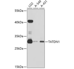 Western Blot - Anti-TATDN1 Antibody (A80739) - Antibodies.com