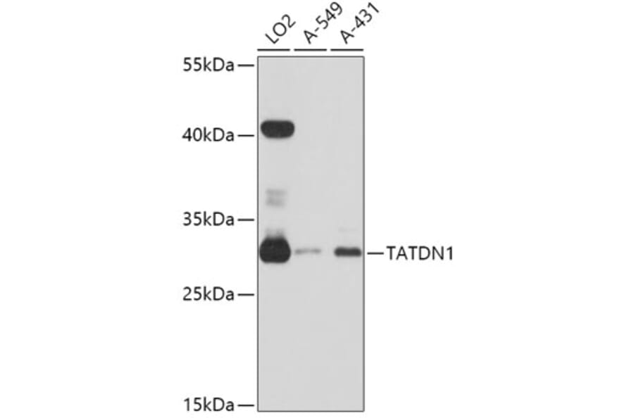Western Blot - Anti-TATDN1 Antibody (A80739) - Antibodies.com