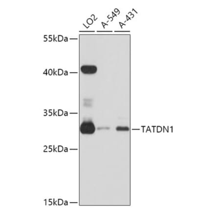 Western Blot - Anti-TATDN1 Antibody (A80739) - Antibodies.com