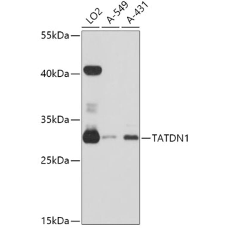 Western Blot - Anti-TATDN1 Antibody (A80739) - Antibodies.com