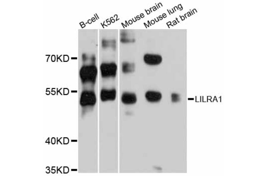 Western Blot - Anti-LILRA1 Antibody (A12111) - Antibodies.com