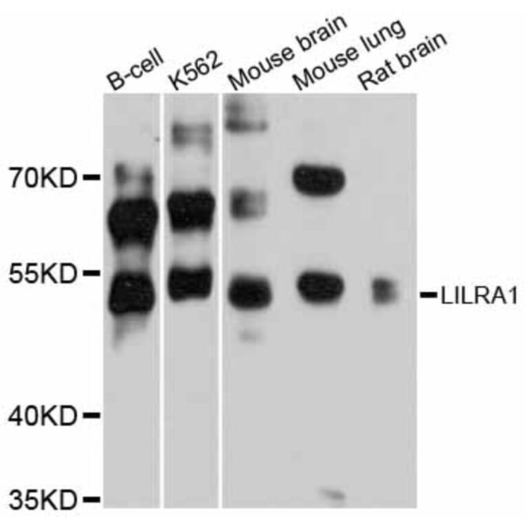 Western Blot - Anti-LILRA1 Antibody (A12111) - Antibodies.com