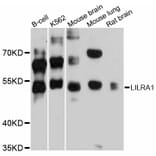 Western Blot - Anti-LILRA1 Antibody (A12111) - Antibodies.com