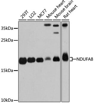Western blot analysis of extracts of various cell lines, using Anti-NDUFA8 Antibody (A12118) at 1:3000 dilution.
Secondary antibody: Goat Anti-Rabbit IgG (H+L) (HRP) (AS014) at 1:10,000 dilution.
Lysates / proteins: 25µg per lane.
Blocking buffer: 3% non-fat dry milk in TBST.
Detection: ECL Basic Kit (RM00020).
Exposure time: 30s.