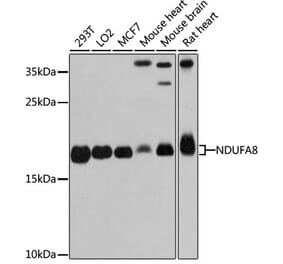 Western Blot - Anti-NDUFA8 Antibody (A80741) - Antibodies.com