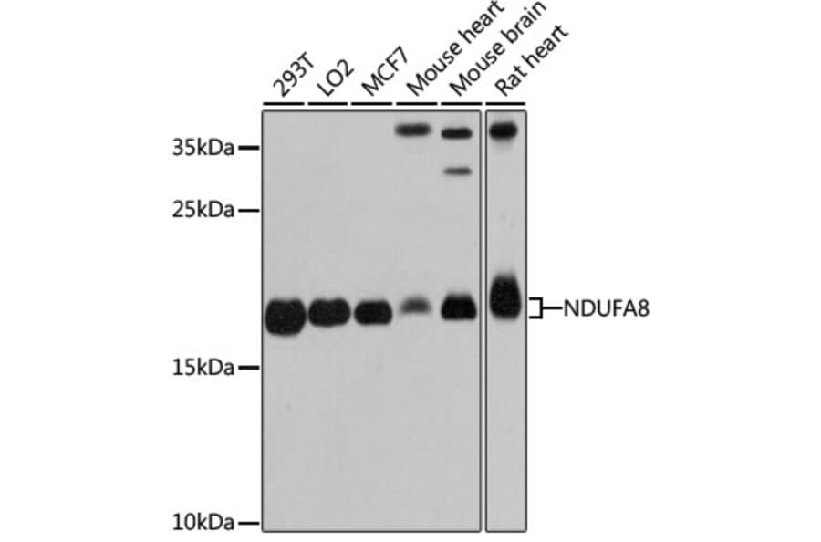 Western Blot - Anti-NDUFA8 Antibody (A80741) - Antibodies.com