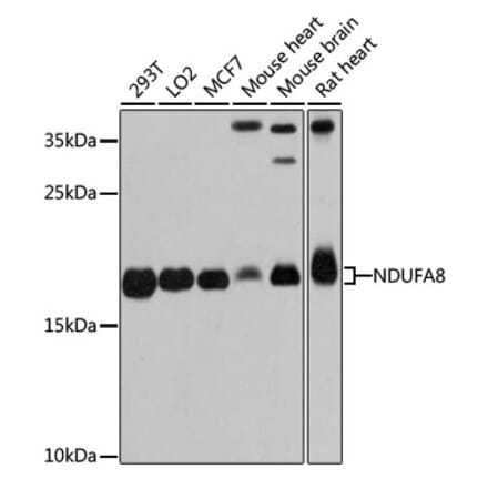 Western Blot - Anti-NDUFA8 Antibody (A80741) - Antibodies.com