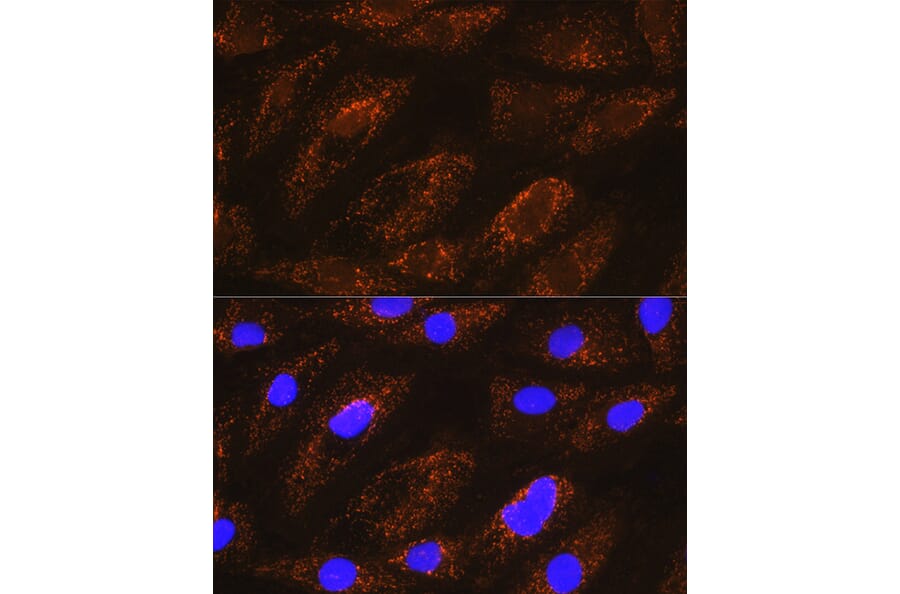 Immunofluorescence - Anti-NDUFA8 Antibody (A80741) - Antibodies.com